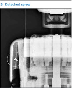 Beta Tdworld Com Sites Tdworld com Files Detached Screw Revealed By Radiography 20131204 Beta Tdworld Com Sites Tdworld com Files Detached Screw Revealed By Radiography 20131204