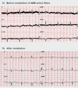 Beta Tdworld Com Sites Tdworld com Files Ecg Recorded In The Emergency Department 20140306 1 Beta Tdworld Com Sites Tdworld com Files Ecg Recorded In The Emergency Department 20140306 1