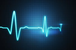 Illustration of EKG cardiogram for monitoring heartbeat Illustration of EKG cardiogram for monitoring heartbeat