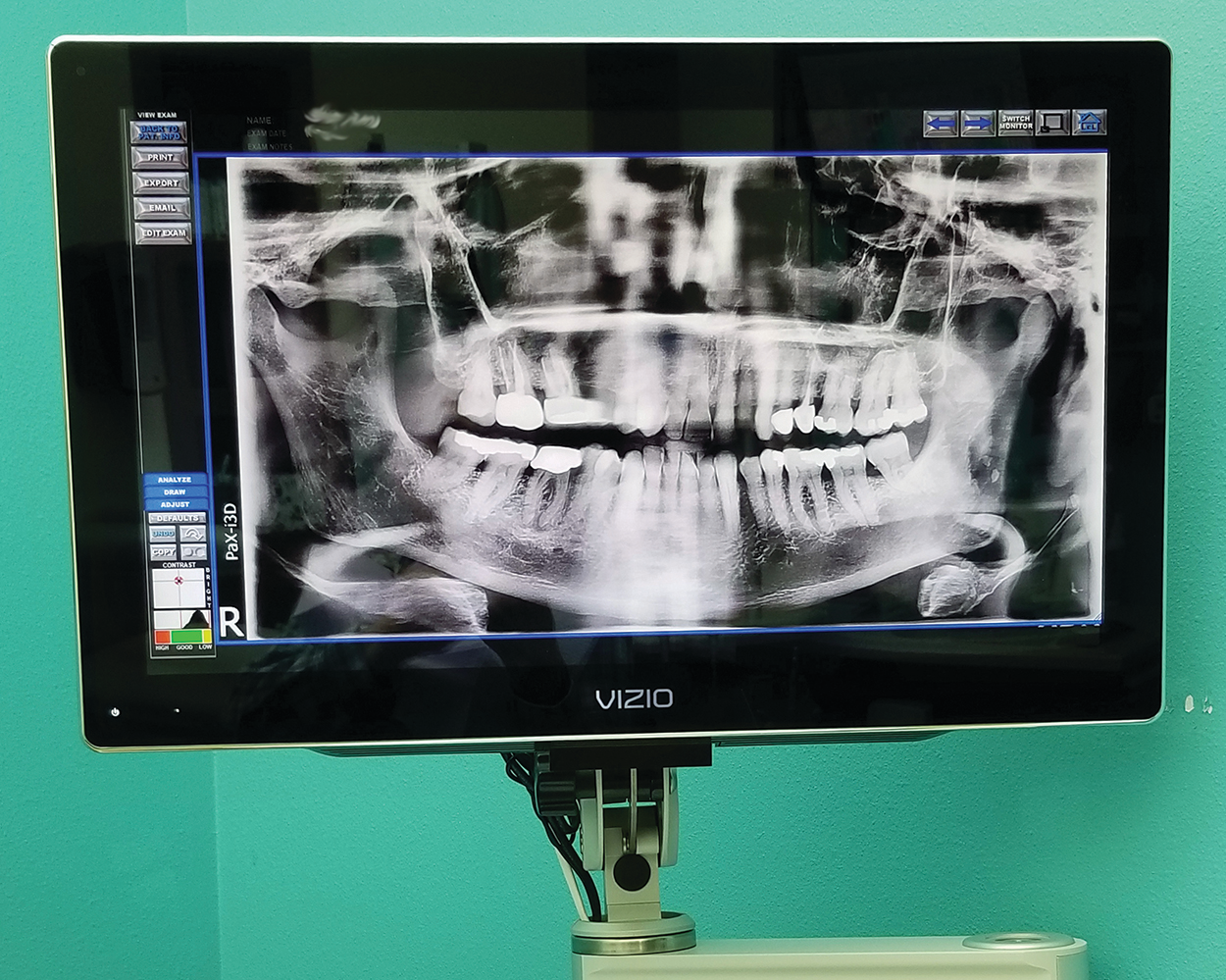 Tr 05 Panoramic X Ray 5e4277d1b8351